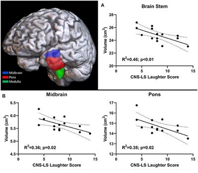 Brainstem Correlates of Pathological Laughter and Crying Frequency in ALS